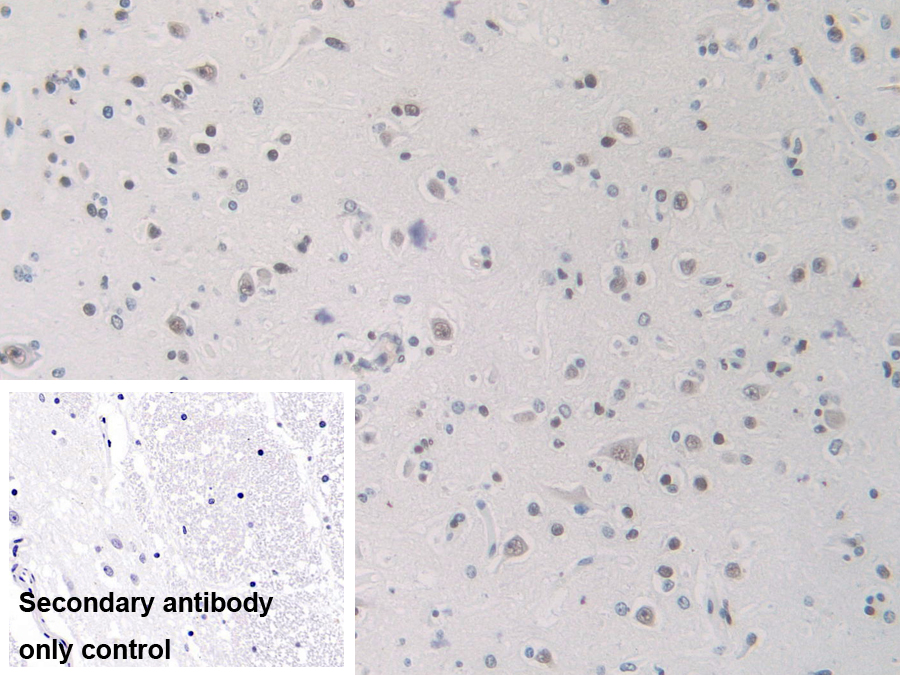 Polyclonal Antibody to Heterogeneous Nuclear Ribonucleoprotein A1 (HNRNPA1)