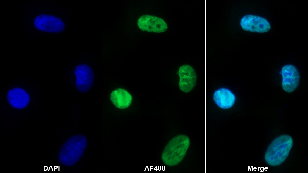 Polyclonal Antibody to Heterogeneous Nuclear Ribonucleoprotein A1 (HNRNPA1)