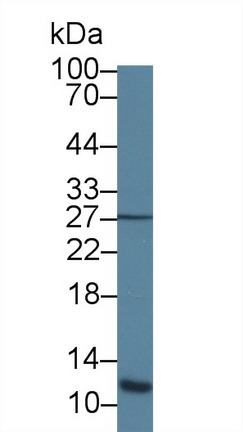 Polyclonal Antibody to Acylphosphatase 1, Erythrocyte (ACYP1)