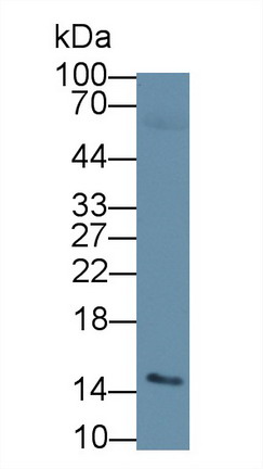 Polyclonal Antibody to Acylphosphatase 2 (ACYP2)