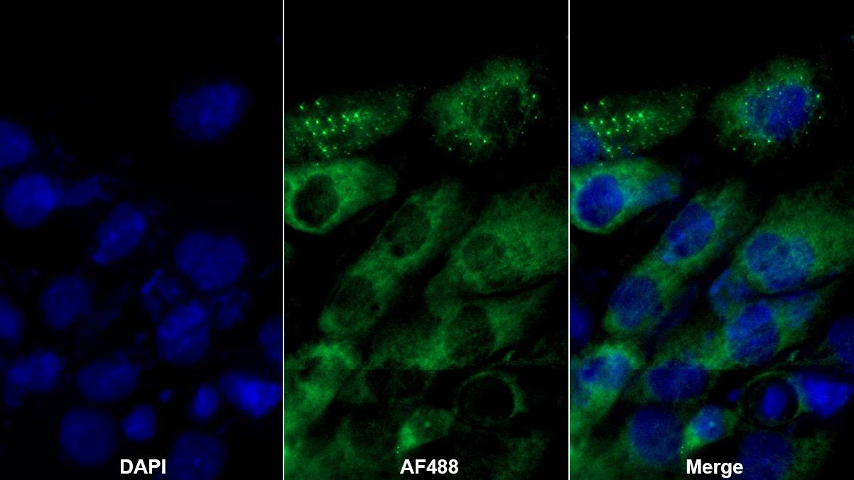 Polyclonal Antibody to Mesencephalic Astrocyte Derived Neurotrophic Factor (MANF)