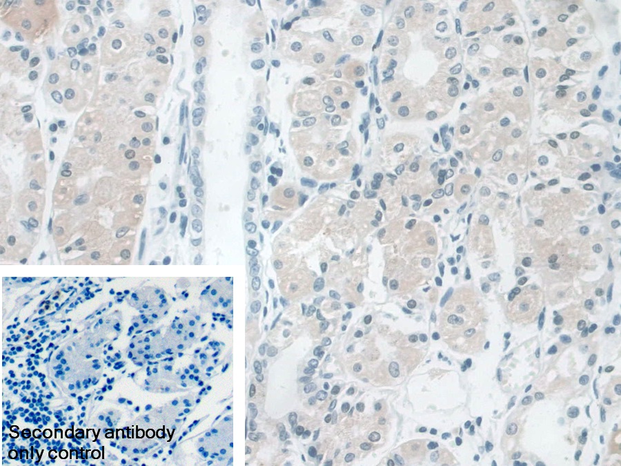 Polyclonal Antibody to Ancient Ubiquitous Protein 1 (AUP1)