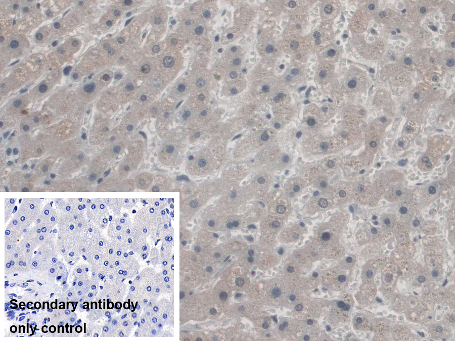 Polyclonal Antibody to Antizyme Inhibitor 1 (AZIN1)