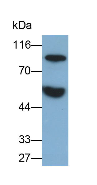 Polyclonal Antibody to Antithrombin (AT)