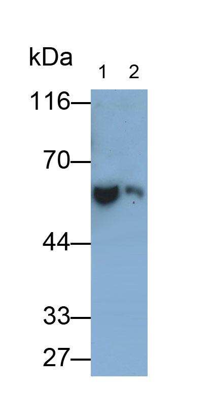 Polyclonal Antibody to Antithrombin (AT)