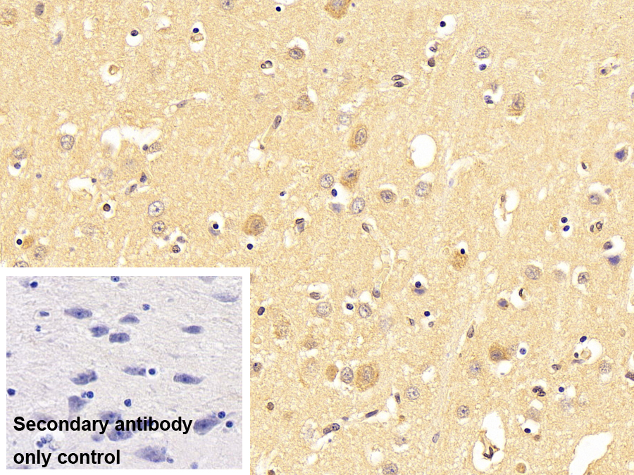 Polyclonal Antibody to Aromatase (ARO)