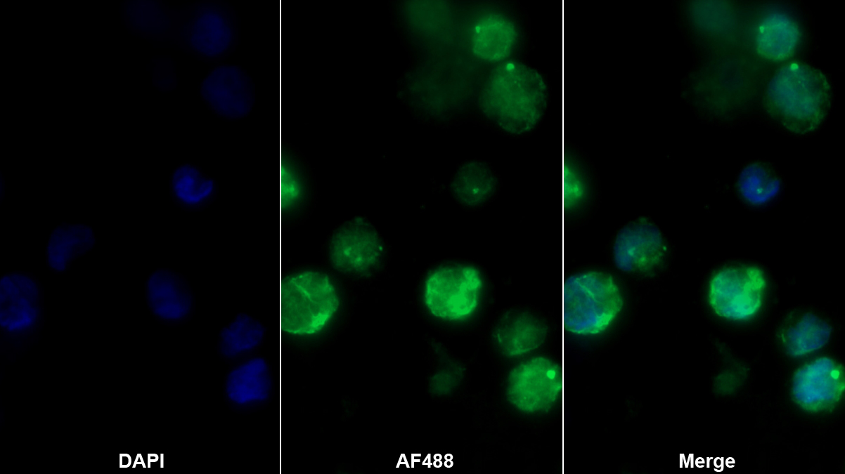 Polyclonal Antibody to Aspartylglucosaminidase (AGA)