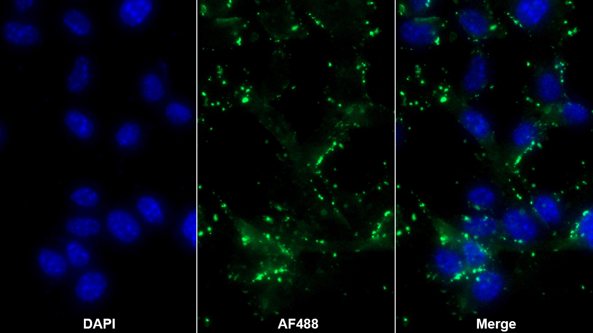 Polyclonal Antibody to Carboxylesterase 1 (CES1)