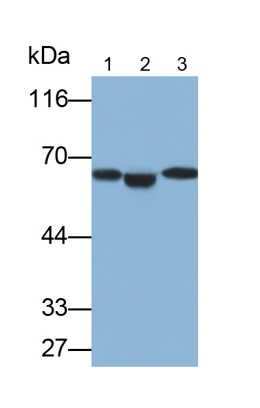 Polyclonal Antibody to Calcitonin Receptor (CTR)