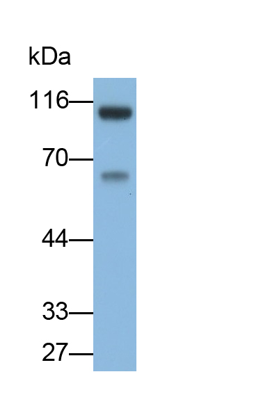 Polyclonal Antibody to Calpastatin (CAST)