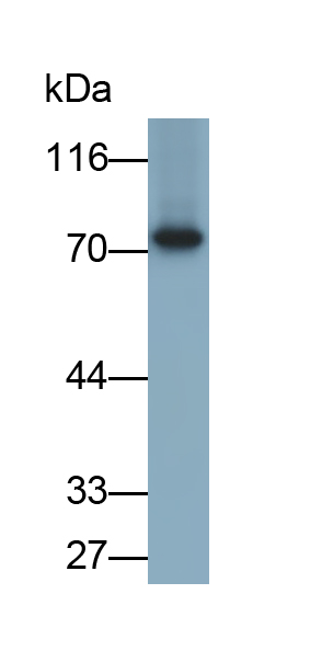 Polyclonal Antibody to Carnitine Palmitoyltransferase 2, Mitochondrial (CPT2)