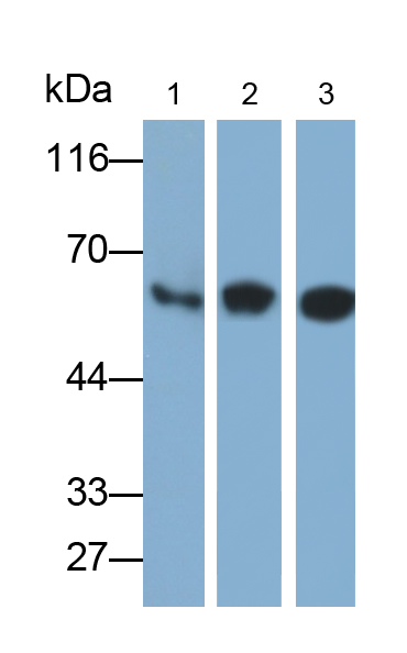 Polyclonal Antibody to Catalase (CAT)