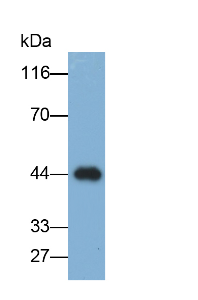 Polyclonal Antibody to Doublecortin (DCX)