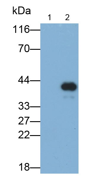 Polyclonal Antibody to Doublecortin (DCX)
