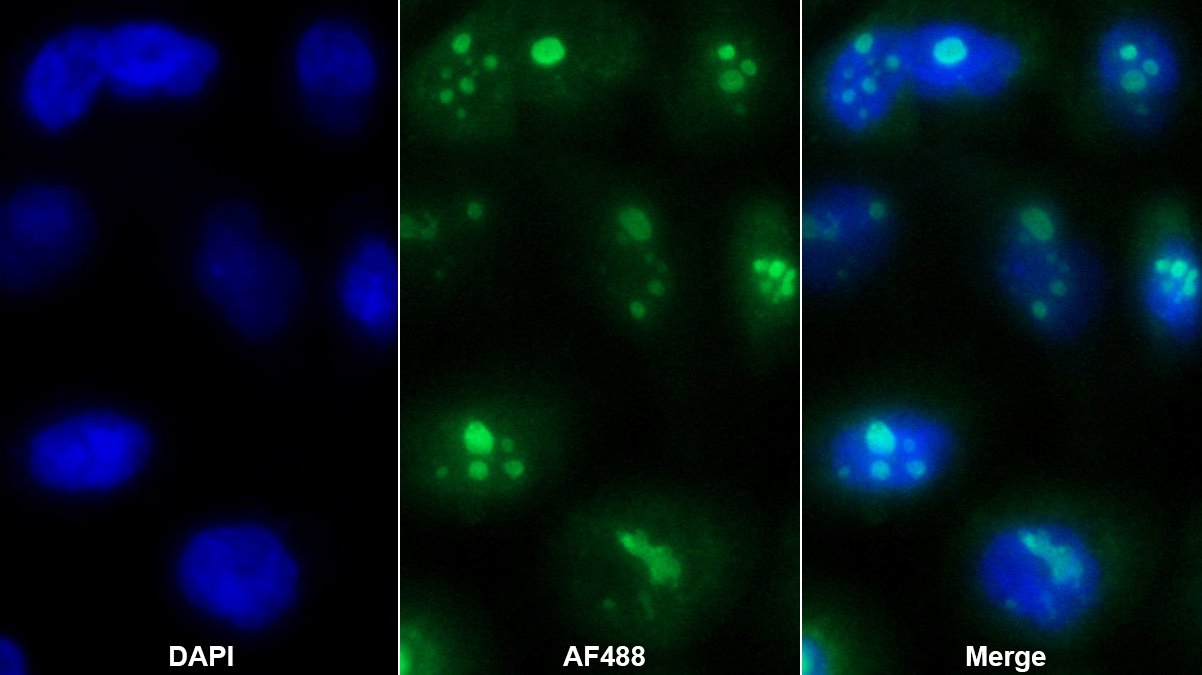 Polyclonal Antibody to Dyskerin (DKC)
