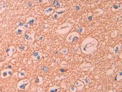 Polyclonal Antibody to Epithelial Cell Transforming Sequence 2 (ECT2)