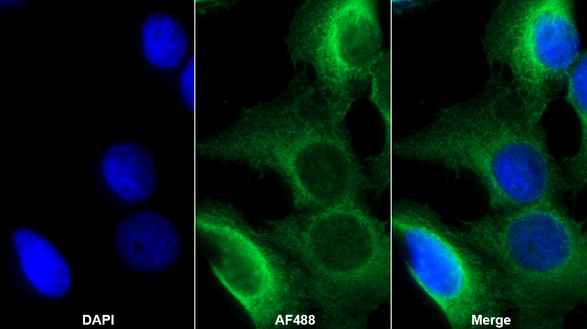 Polyclonal Antibody to Fatty Acid Synthase (FASN)