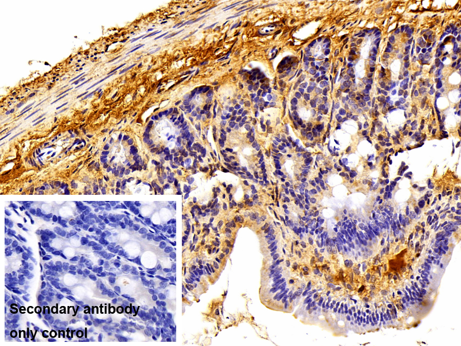 Polyclonal Antibody to Fibulin 1 (FBLN1)