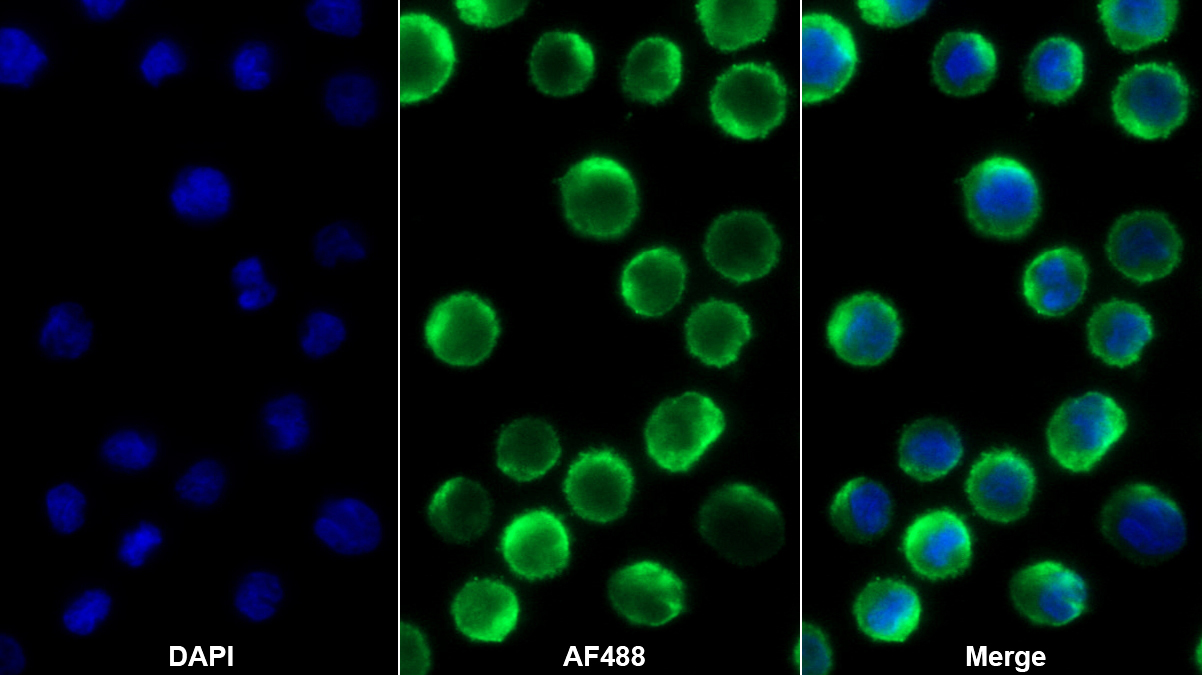 Polyclonal Antibody to Fasciculation And Elongation Protein Zeta 1 (FEz1)