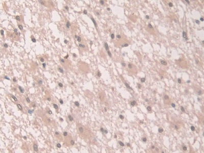 Polyclonal Antibody to Grancalcin (GCA)