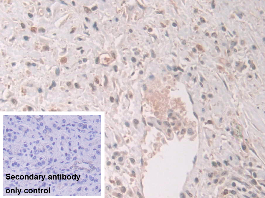 Polyclonal Antibody to Grancalcin (GCA)