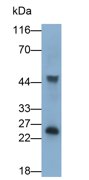 Polyclonal Antibody to Grancalcin (GCA)