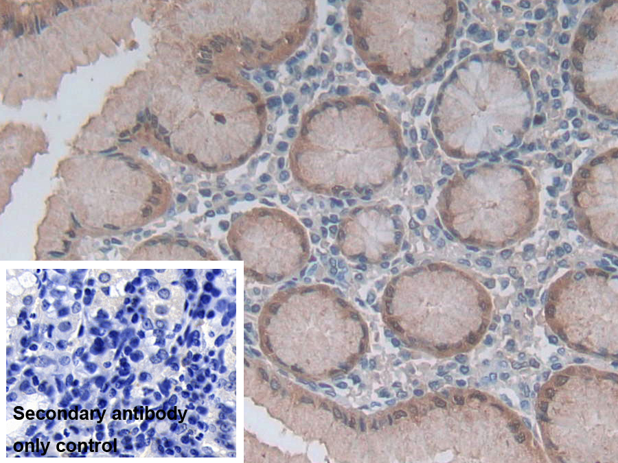 Polyclonal Antibody to Gastrokine 1 (GKN1)