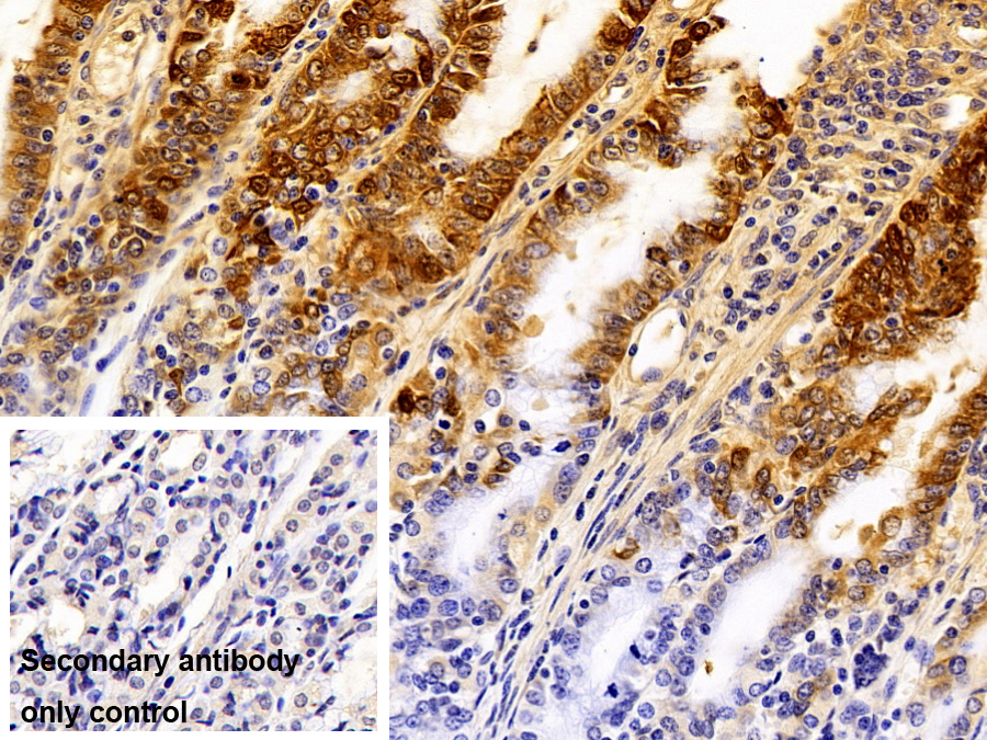 Polyclonal Antibody to Gastrokine 1 (GKN1)