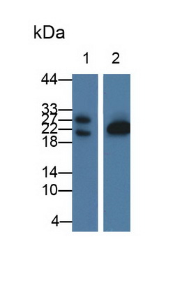Polyclonal Antibody to Glycolipid Transfer Protein (GLTP)