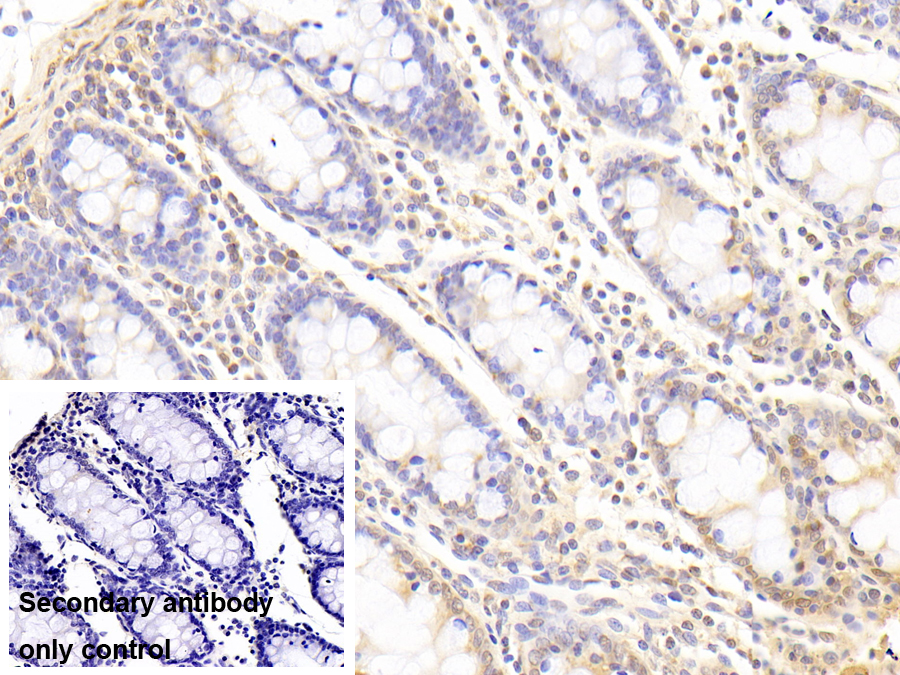 Polyclonal Antibody to Hyaluronan Binding Protein 2 (HABP2)