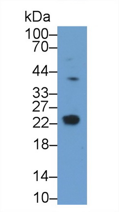 Polyclonal Antibody to Heart And Neural Crest Derivatives Expressed Protein 1 (HAND1)