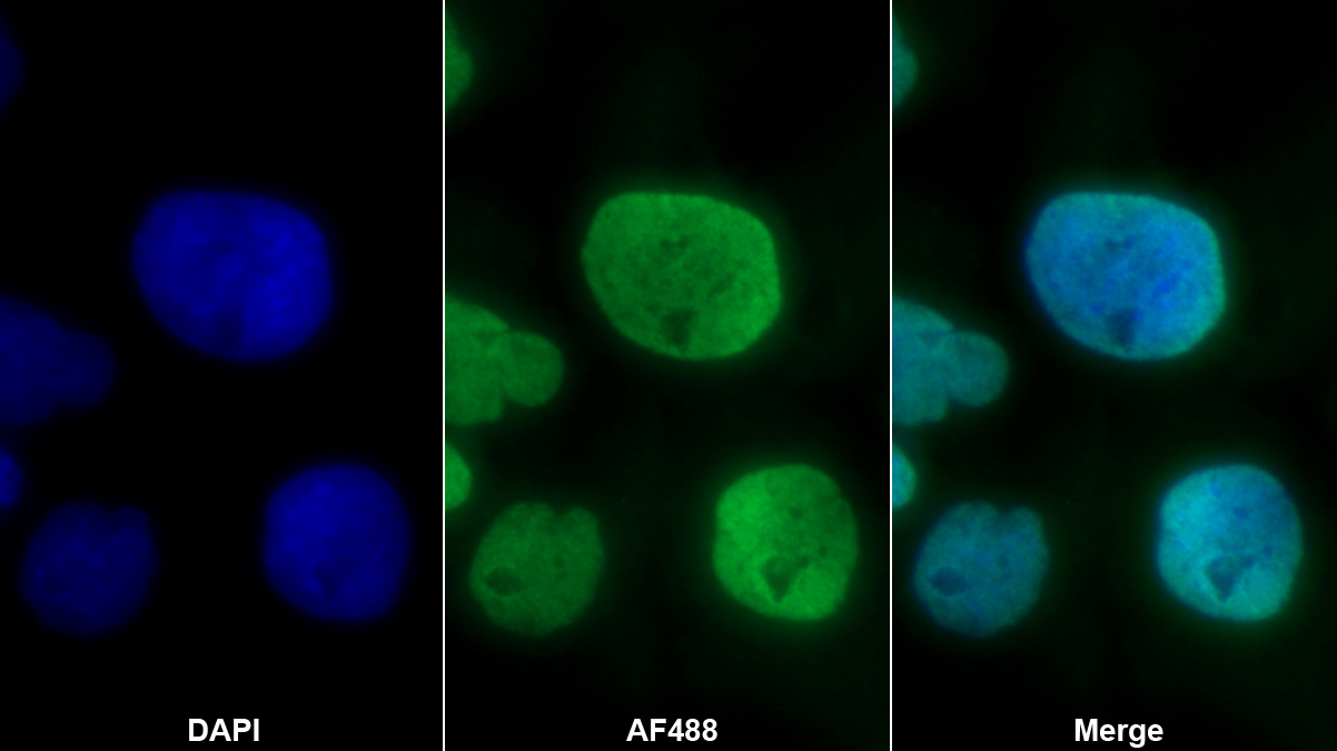 Polyclonal Antibody to Histone H1 (H1)