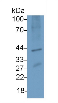 Polyclonal Antibody to General Transcription Factor IIA, Polypeptide 1 (GTF2A1)