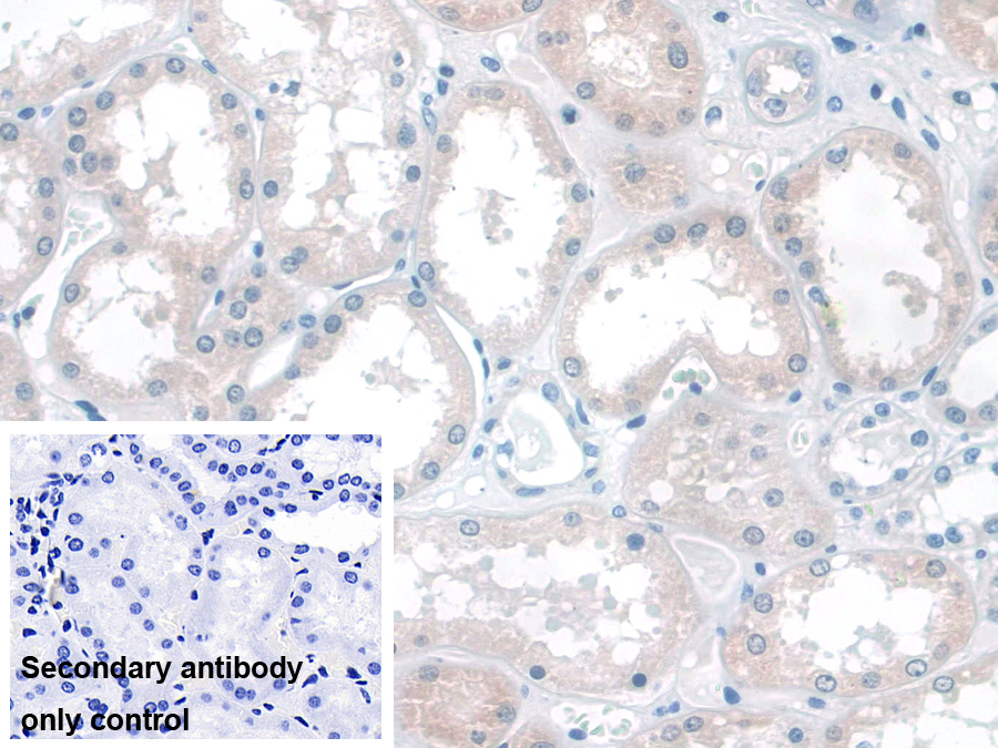 Polyclonal Antibody to Katanin P60 Subunit A 1 (KATNA1)