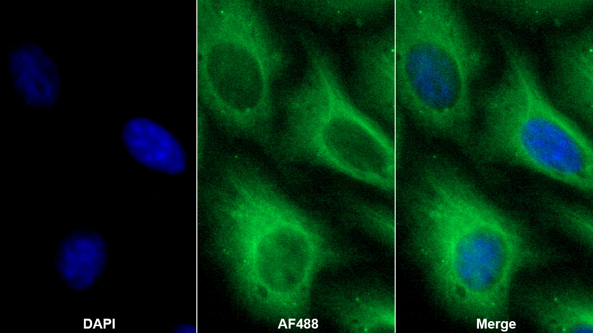 Polyclonal Antibody to Keratocan (KERA)