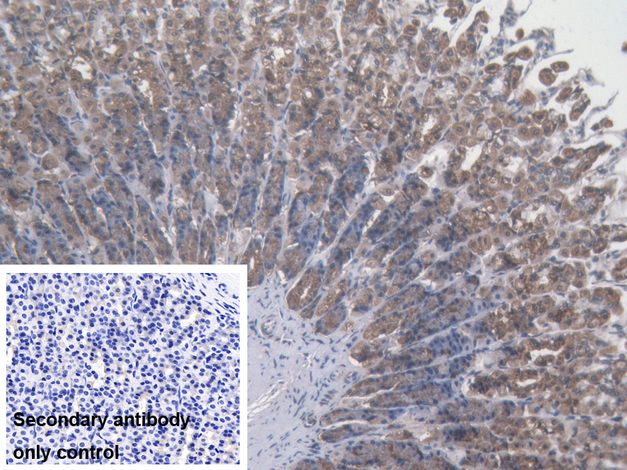 Polyclonal Antibody to Kinectin 1 (KTN1)