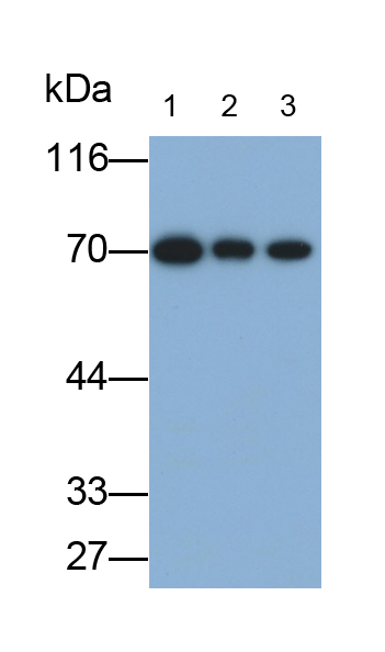 Polyclonal Antibody to L-Plastin (LCP1)