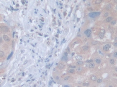 Polyclonal Antibody to Leucine Zipper, Down Regulated In Cancer 1 (LDOC1)