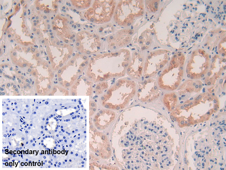 Polyclonal Antibody to Legumain (LGMN)