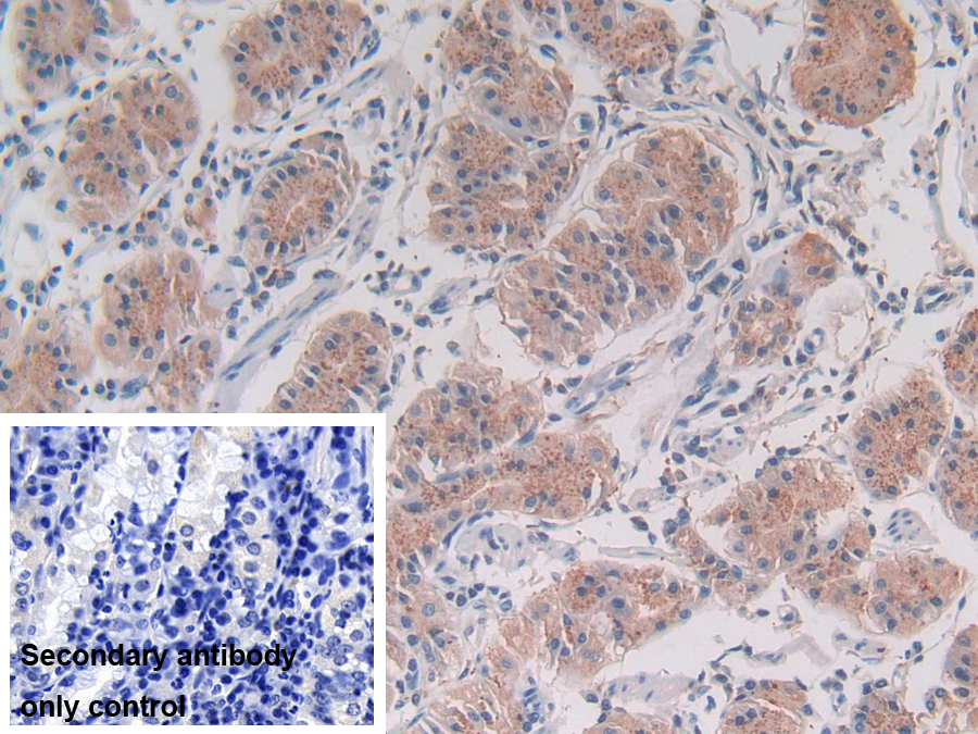 Polyclonal Antibody to Legumain (LGMN)