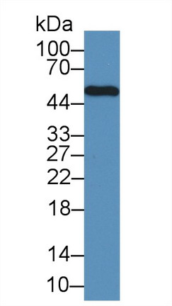 Polyclonal Antibody to Lymphocyte Specific Protein 1 (LSP1)
