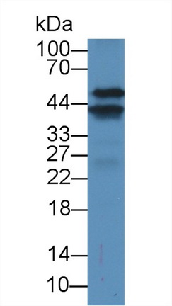 Polyclonal Antibody to Lymphocyte Specific Protein 1 (LSP1)