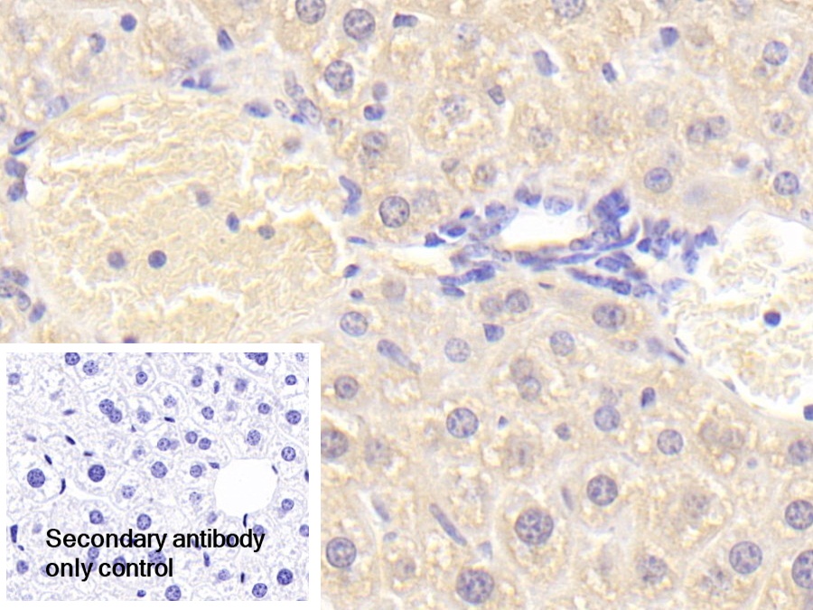 Polyclonal Antibody to Lysophospholipase I (LYPLA1)