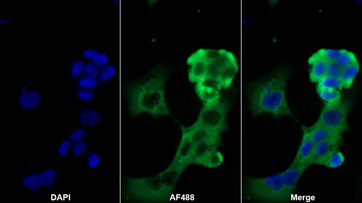 Polyclonal Antibody to Lacritin (LACRT)