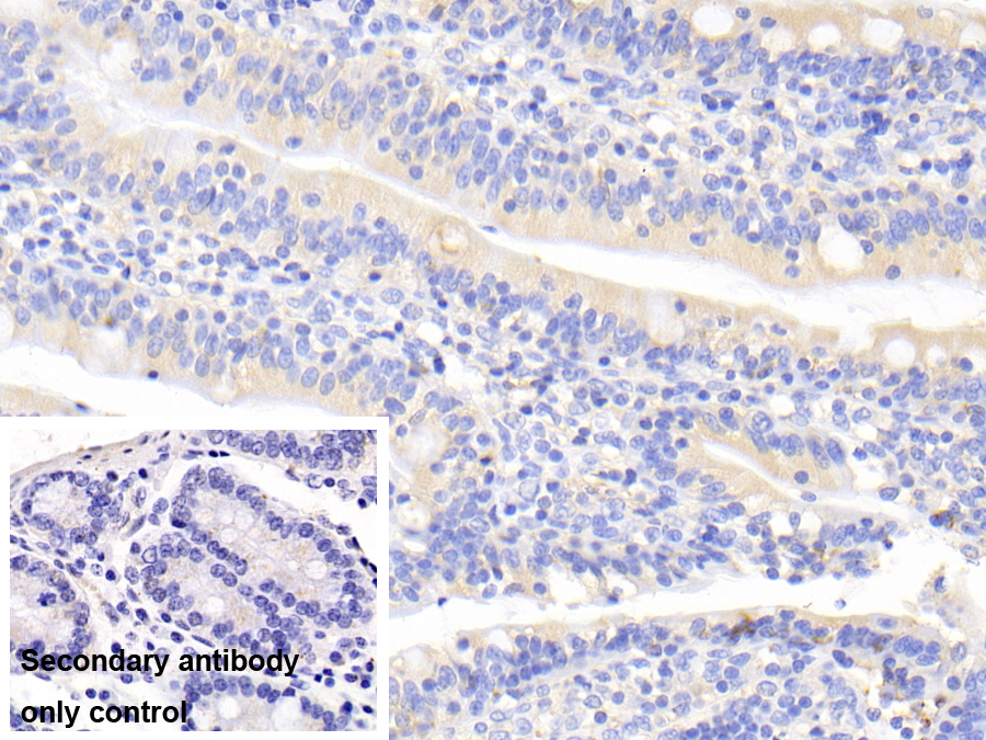 Polyclonal Antibody to Urocortin 2 (UCN2)