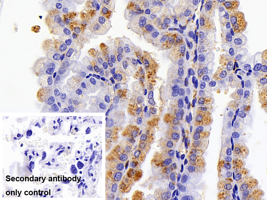 Polyclonal Antibody to Urocortin 2 (UCN2)