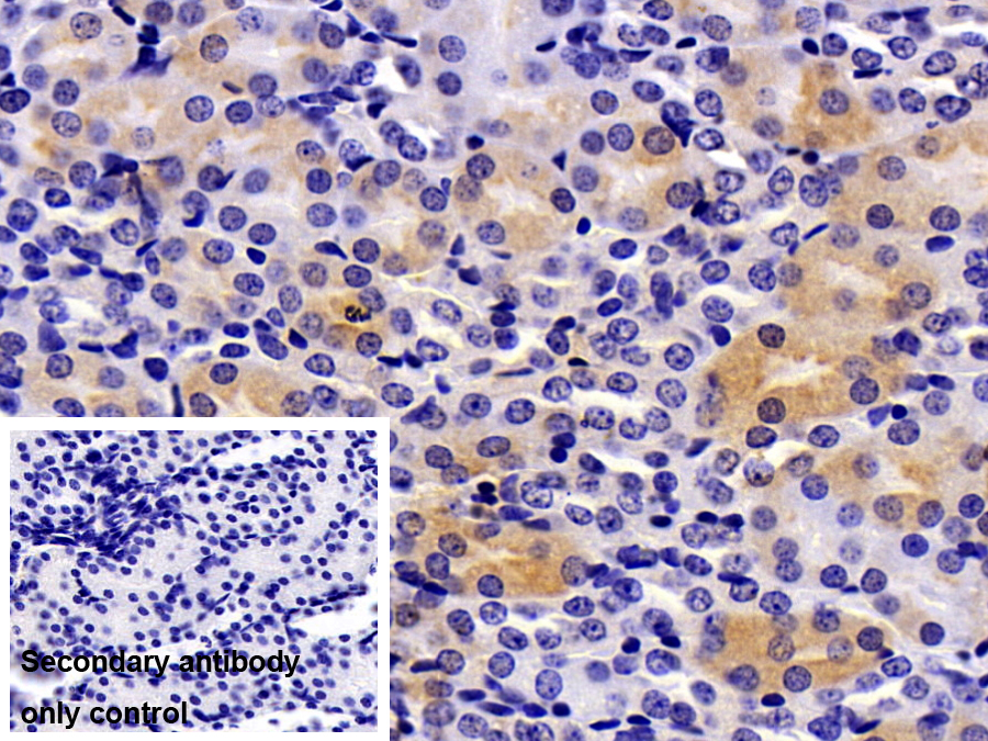 Polyclonal Antibody to Beta-ureidopropionase (UPB1)