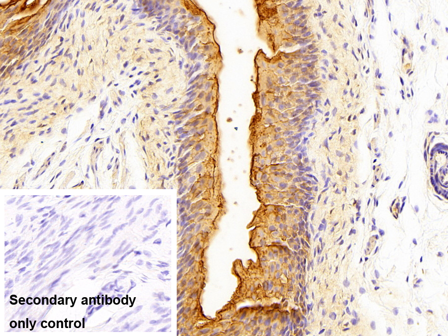 Polyclonal Antibody to Uroplakin 1A (UPK1A)