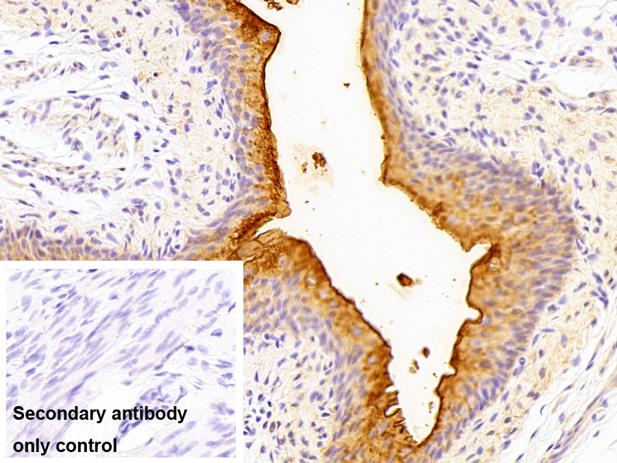 Polyclonal Antibody to Uroplakin 1A (UPK1A)