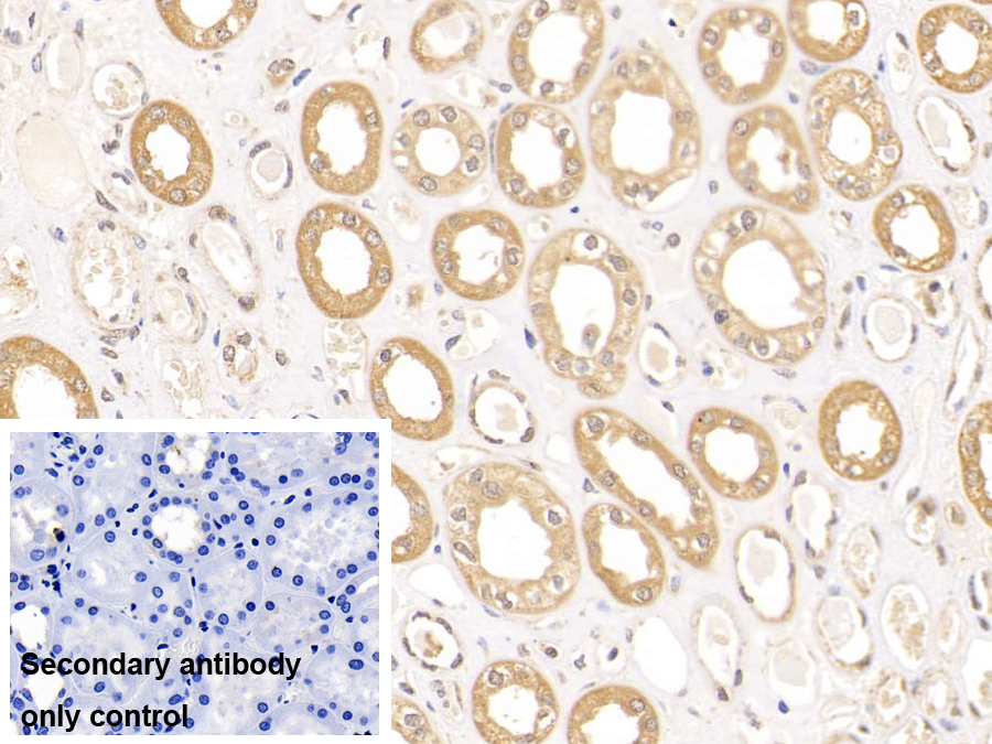 Polyclonal Antibody to Villin (VIL)